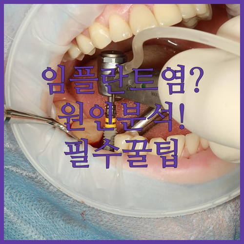 image 317af64d